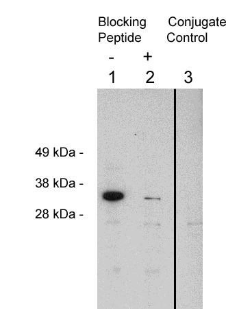 Western blot using Exalpha’s X1874P, rabbit polyclonal at 0.4 ug/ml on HeLa cell extract (10 ug/lane). Blots were developed with goat anti-rabbit Ig (1:75k) and Pierce’s Supersignal West Femto system. Lane: 1- X1874P at 0.4 ug/ml. 2- X1874P plus 16 ug blocking peptide. 3 - Goat anti Rabbit HRP control.